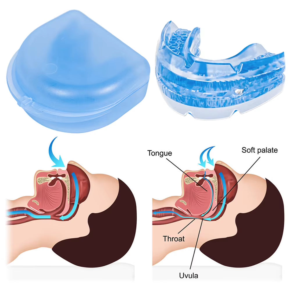 Anti Snoring Mouth Guard anti Snoring Mouthpiece Improve Sleep Grinding Mouthpiece Adjustable Mouthguard for Men Women